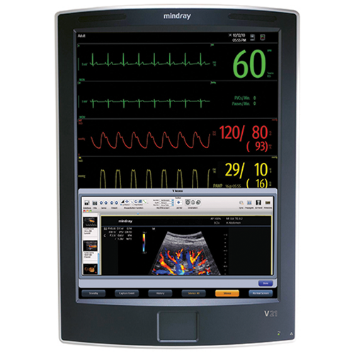 Mindray V21 Patient Monitor - 21" TouchScreen with Co2 (Refurbished)