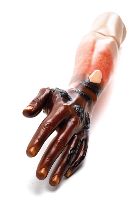 Arm; Lft-Rams Wound-STD - Laerdal 312054