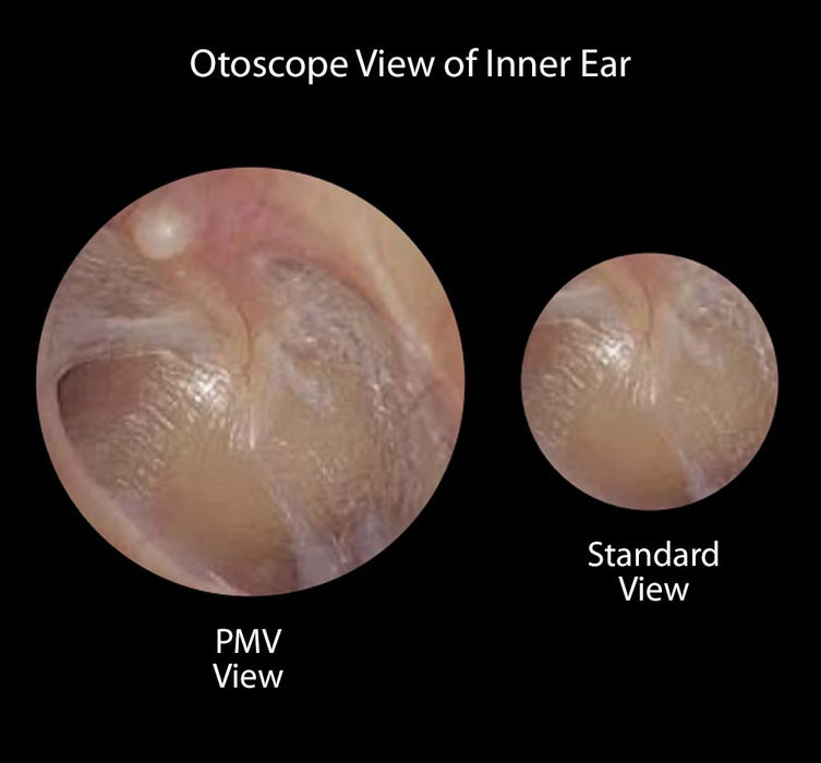 Diagnostix Portable Set, 3.5v USB, OtoL/Coax OphX, Soft - ADC 54310AS