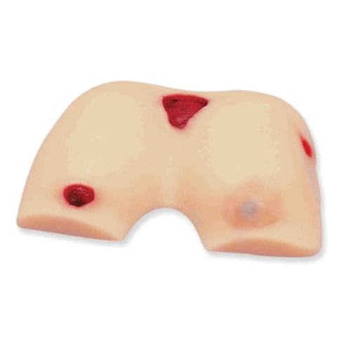 SB14941U - MAN-Nasco Bedsore Cleansing & Dressing Model