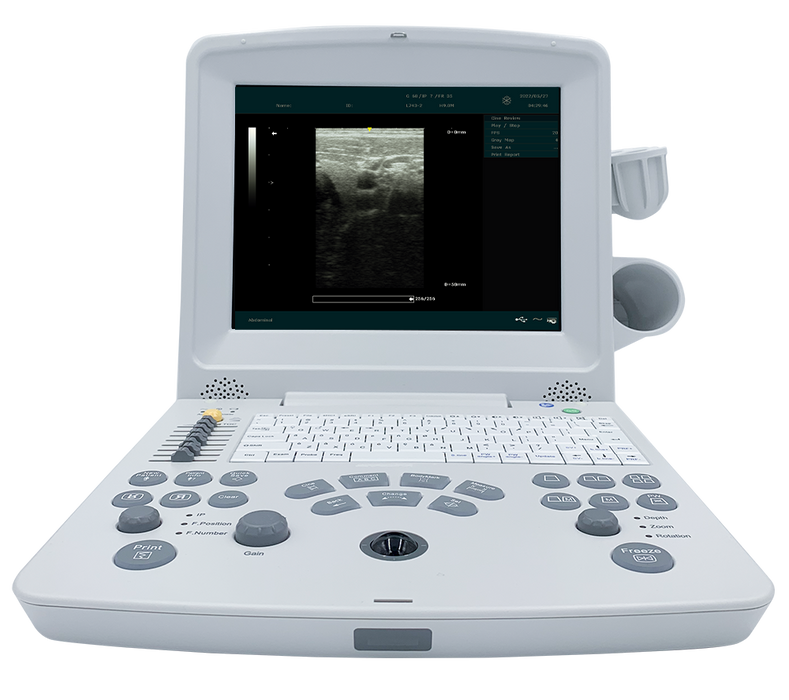 DUS60 Black and White Ultrasound. Does not include transducer - MDPRO DUS60_mainunit