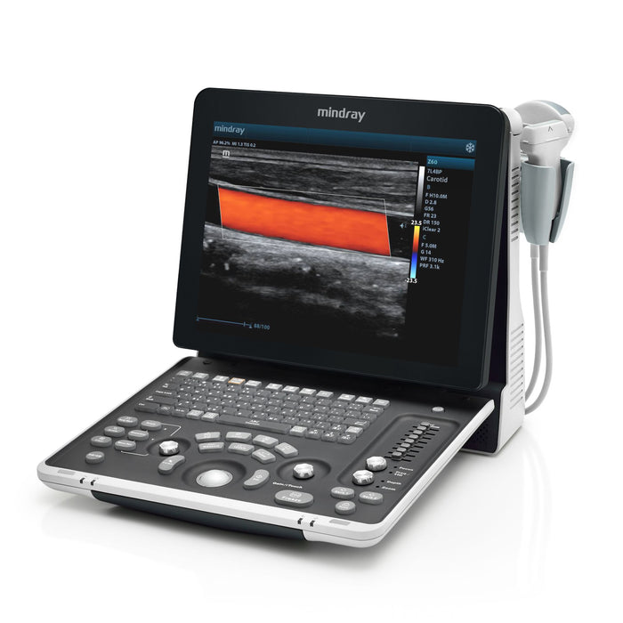 Mindray Z60 Diagnostic Ultrasound System