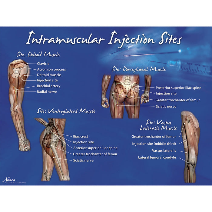 IM Injection Sites Poster - Nasco LF00695