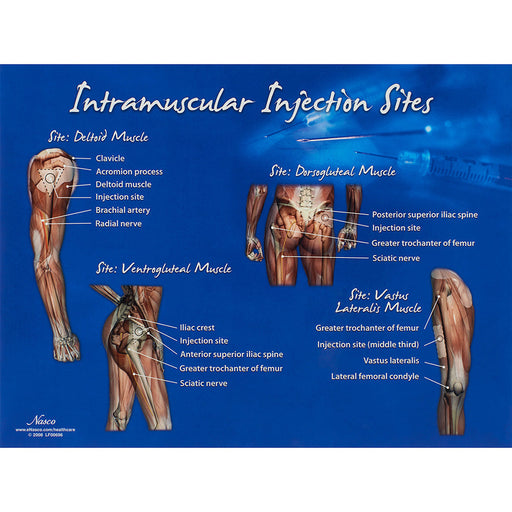 IM Injection Sites Chart - Nasco LF00696