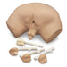 Prostate Palpation Siml - Nasco LF00901 - 2