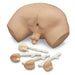 Prostate Palpation Siml - Nasco LF00901 - 1