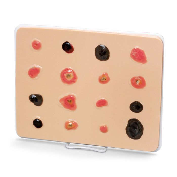 Skin Cancer Trainer Light - Nasco LF00950