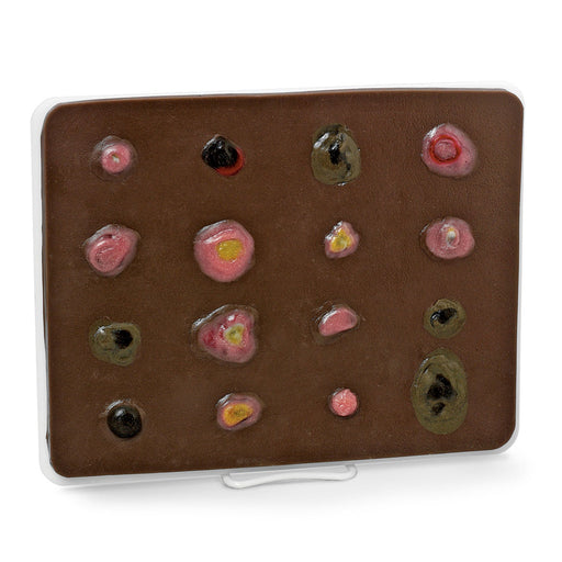 Skin Cancer Trainer Dark - Nasco LF00951