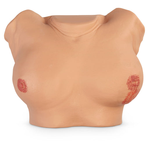 Adv Breast Exam Simulator - Nasco LF00980