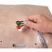 Defibrillation Chest Skin - Nasco LF03652 - 1