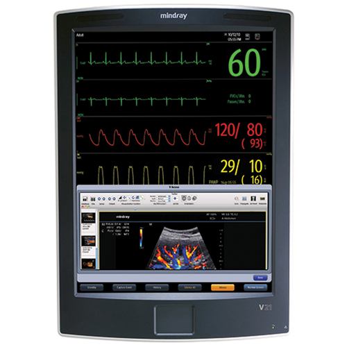 Mindray V21 Patient Monitor - 21" TouchScreen (Refurbished)