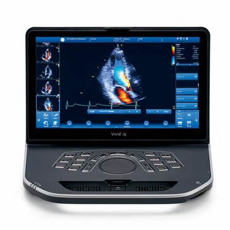 GE Vivid iQ Portable Ultrasound Machine (Refurbished)