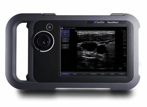 Sonosite Nanomaxx Ultrasound Machine (Refurbished)