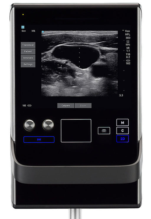 Sonosite SII Ultrasound Machine (Refurbished)