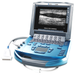 Sonosite MicroMaxx Ultrasound Machine (Refurbished) - 1