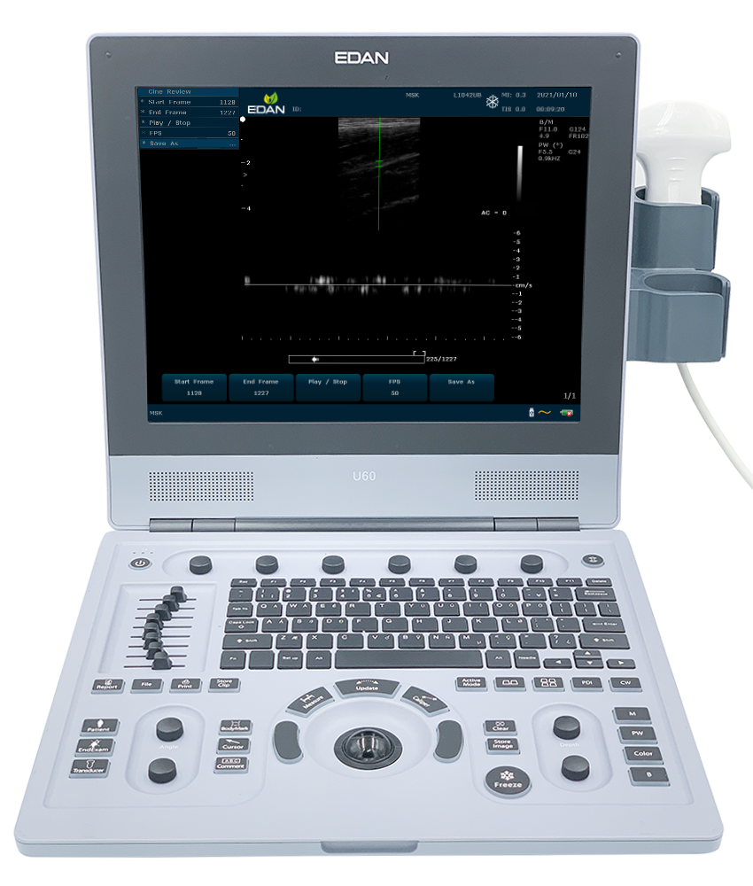 U60 Color Doppler Ultrasound. Does not include transducer. - MDPRO U60 ...