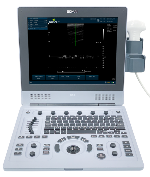 U60 Color Doppler Ultrasound. Does not include transducer. - MDPRO U60_Mainunit