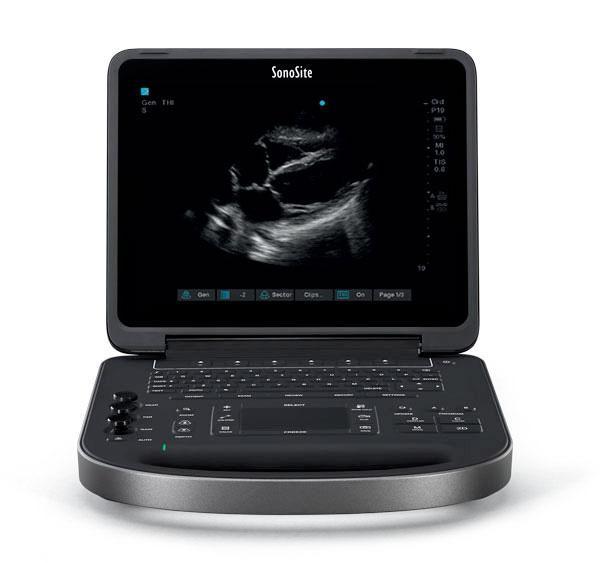 Sonosite Edge II Ultrasound Machine (Refurbished)
