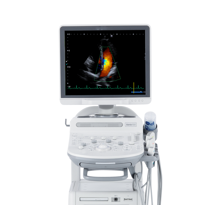 Toshiba Xario 100 Ultrasound Machine (Refurbished)